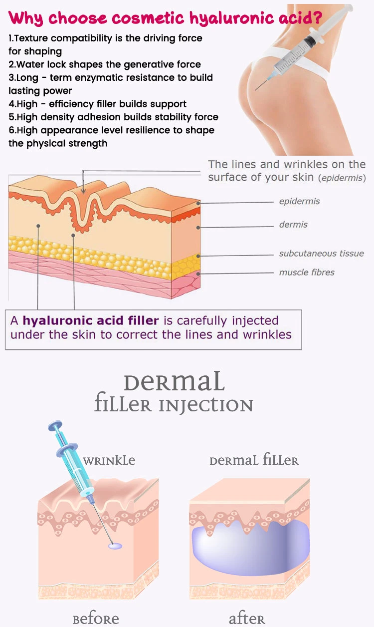 Best Quality Hyaluronic Acid France Dermal Fillers for Breast Augmentation